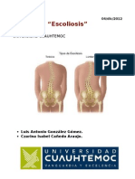 Investigacion - ESCOLIOSIS