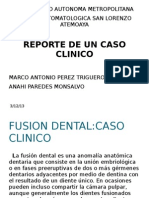 Caso Clinico Fusion Dentaria
