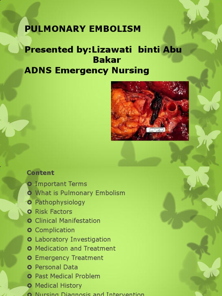 Pulmonary embolism treatment picture