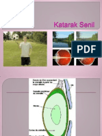 Katarak Senil K