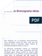 O que é o sinal do broncograma aéreo