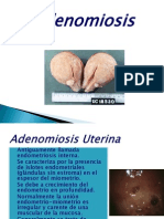 Adenomiosis