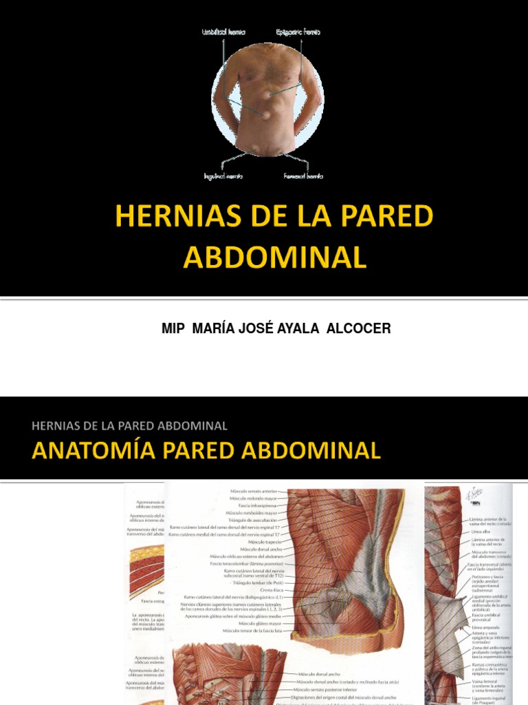 Hernias De La Pared Abdominalppt