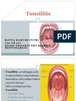 Tonsilitis