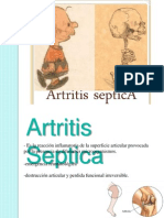 Artritis séptica: causas, síntomas y tratamiento