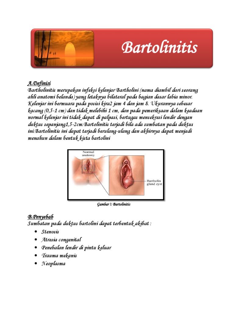 Bartholinitis | PDF | Kesehatan Holistik