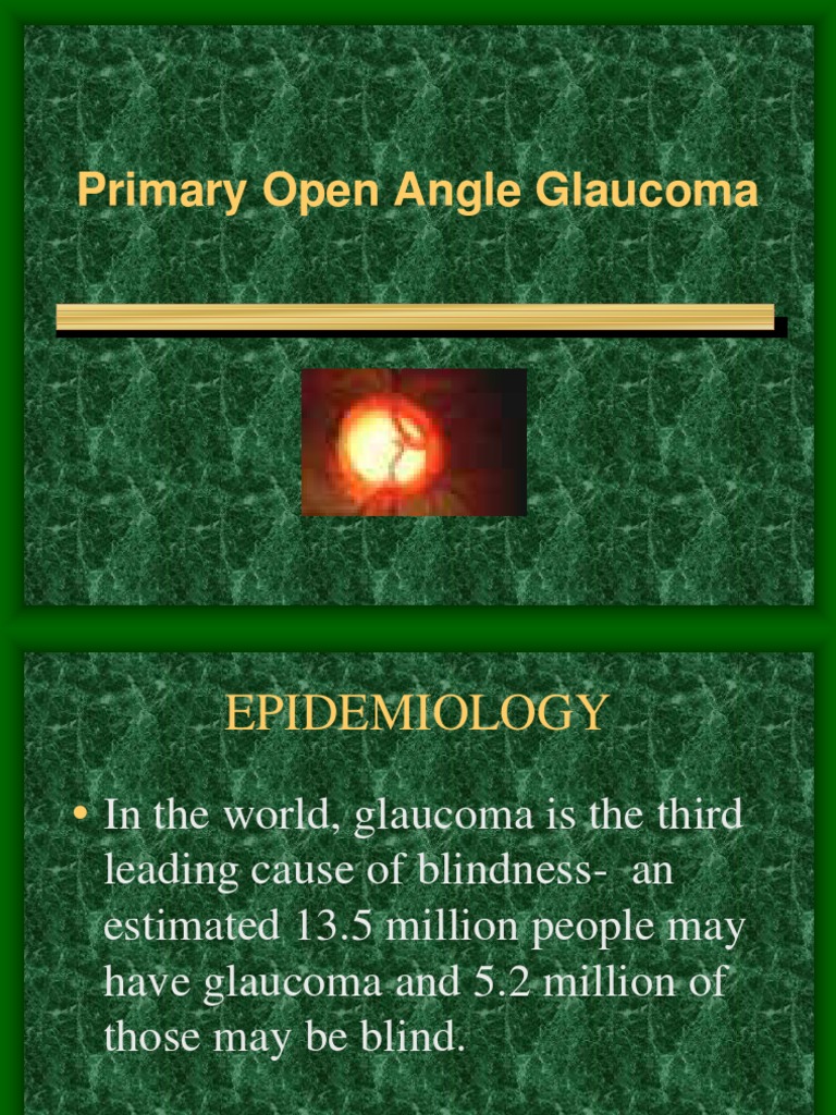 Overview of Primary Open Angle Glaucoma | PDF | Glaucoma | Ophthalmology