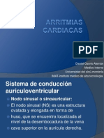 Arritmias Cardiacas