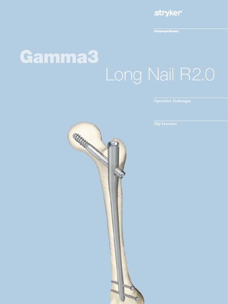 gamma3longnailr2_optech_b0300009d3207 Screw Orthopedic Surgery