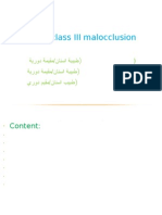 Class III Malocclusion