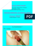 FISTULES ANALES _ Le Choix Des Armes en 2007 Test