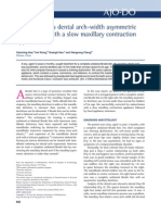 Correction of a Dental Arch-width Asymmetric