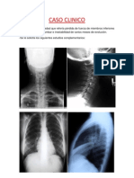 HEMANGIOPERICITOMA