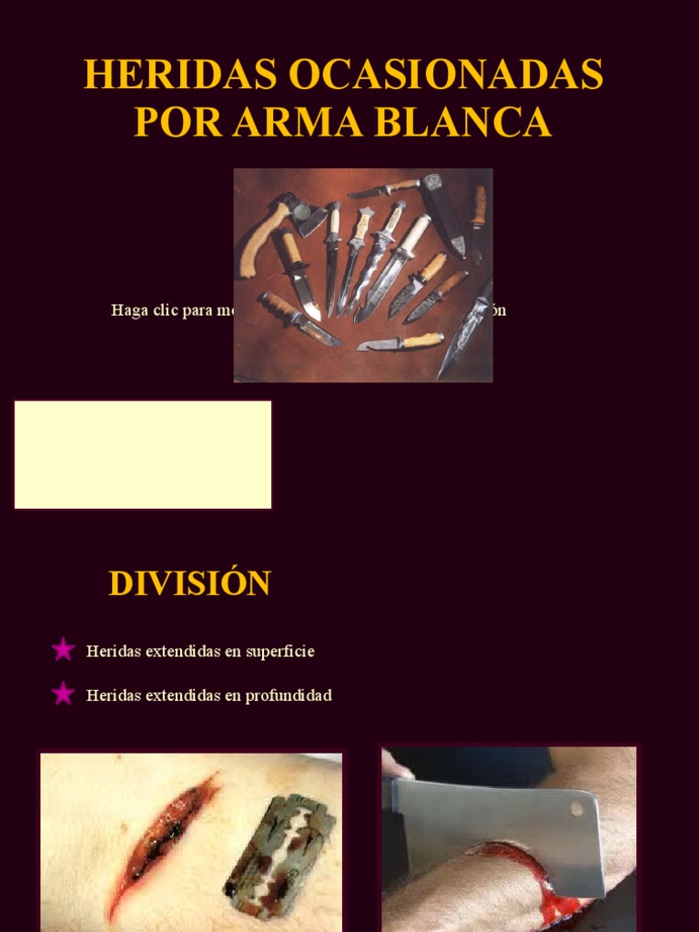 Heridas Ocasionadas Por Arma Blanca | PDF | Vena | Medicina