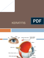 Keratitis