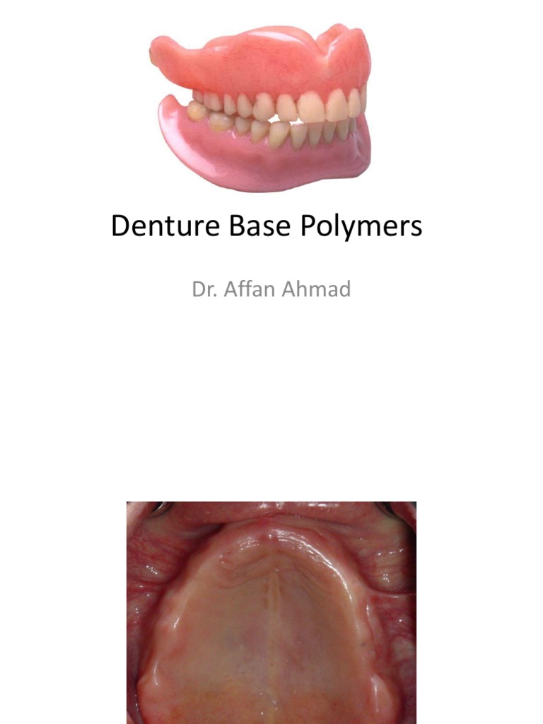 Denture Base Polymers Poly(Methyl Methacrylate) Dentures