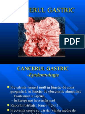 cancerul gastric scribd)
