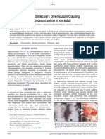 Inverted Meckel's Diverticulum Causing Intussusception in An Adult