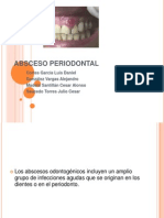 Absceso Periodontal