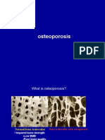 Download Osteoporosis by Corrine SN13167415 doc pdf