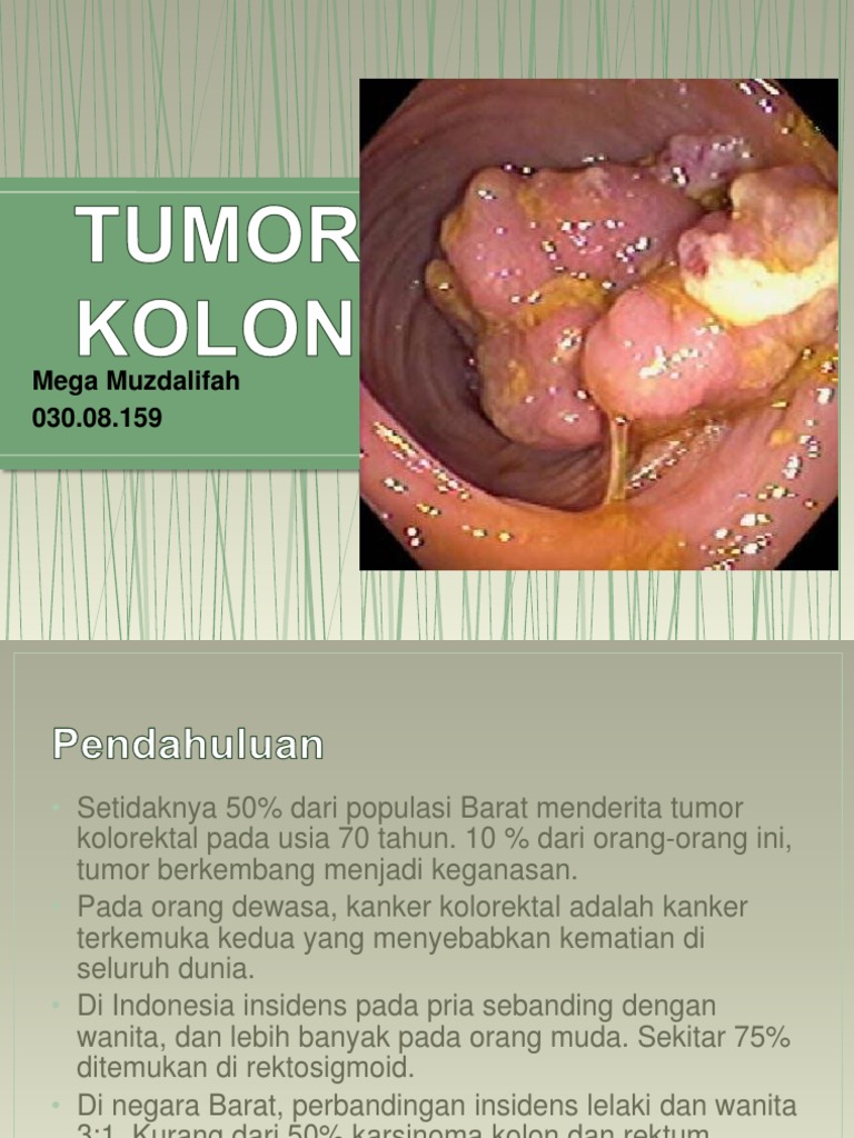 Tumor Kolon Pdf