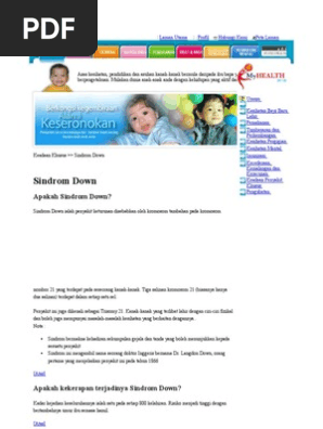 Bila Anak Sulongku Down Syndrome Ibu Ni Kongsi Pengalamannya Untuk Info Bersama Keluarga