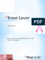 Breast Cancer