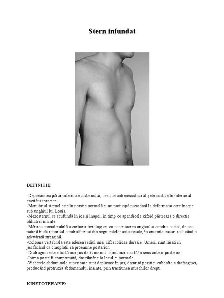 Stern Infundat | PDF