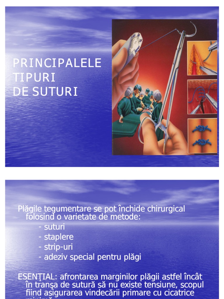 Reguli Si Tipuri de Suturi | PDF