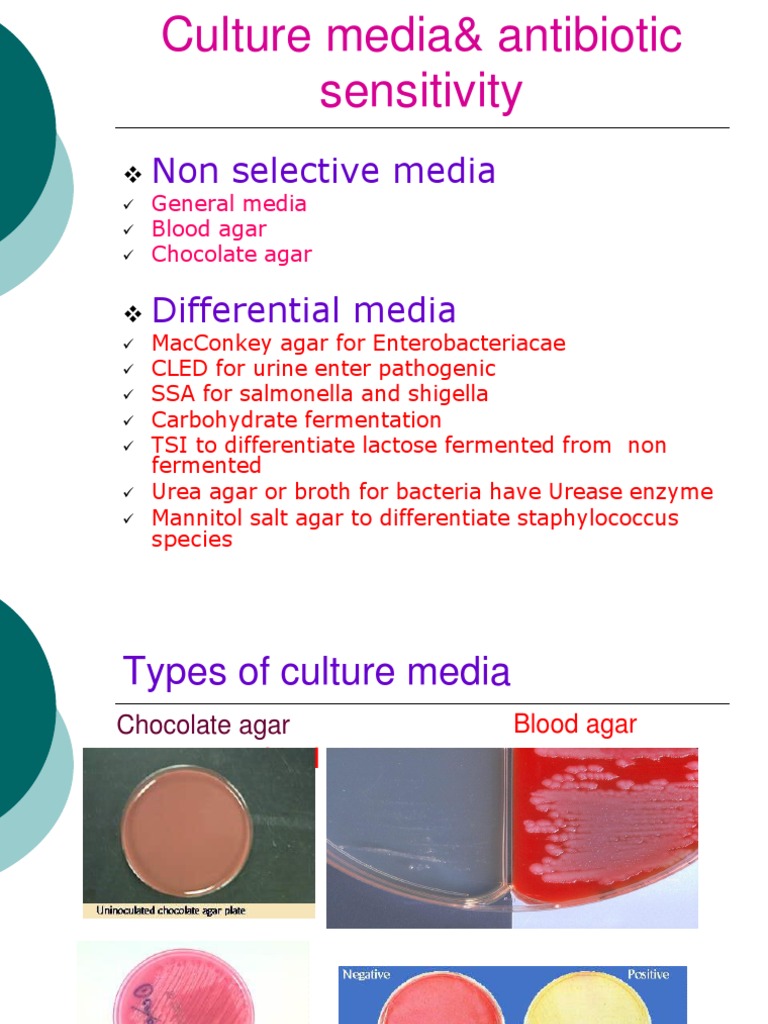 Lab 6 Culture Media& Antibiotic Sensitivity Growth Medium