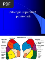 abcese pulmonare