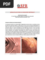 Interview Pilleul Coloscopie Virtuelle