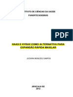 Haas e Hyrax Como Alternativa para Expansão Rápida Maxilar