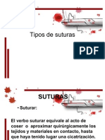 Tipos de Suturas 111201171937 Phpapp02