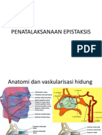 Penatalaksanaan Epistaksis