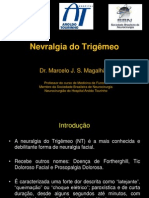 Nevralgia Do Trigêmeo