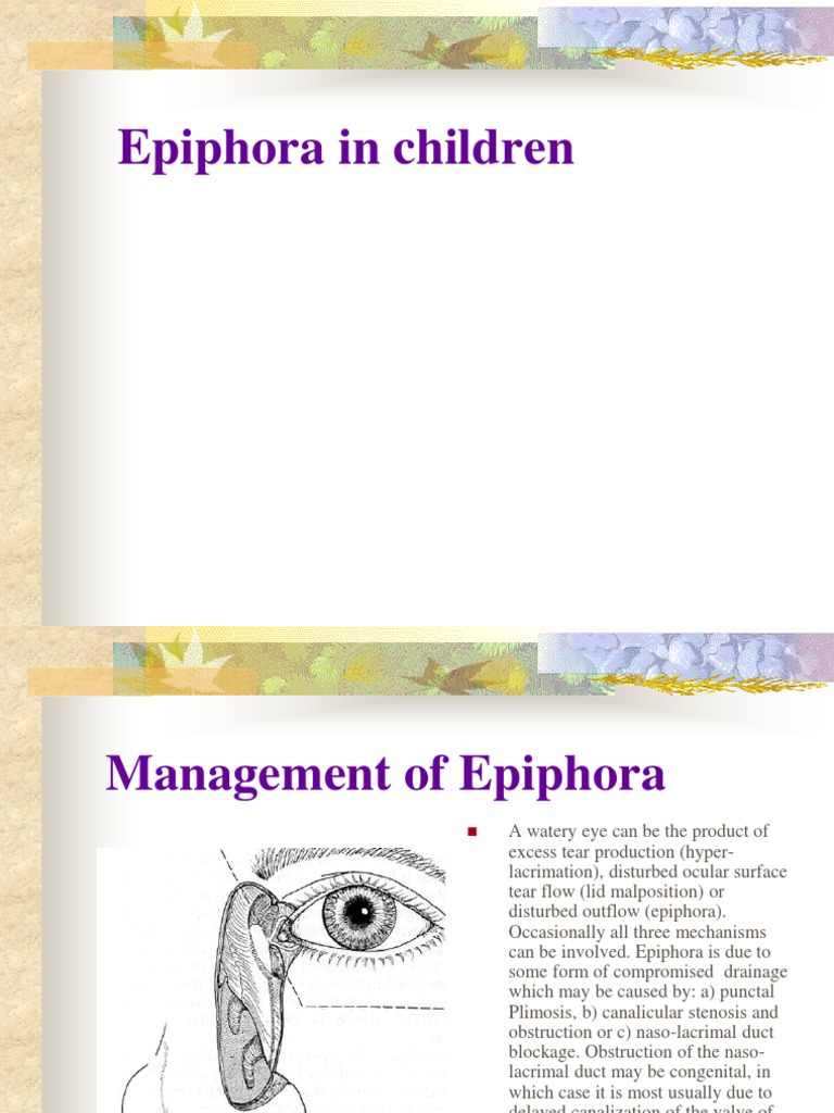 Epiphora Clinical Medicine Medicine