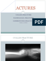 Fracture - Timofte Lidia English