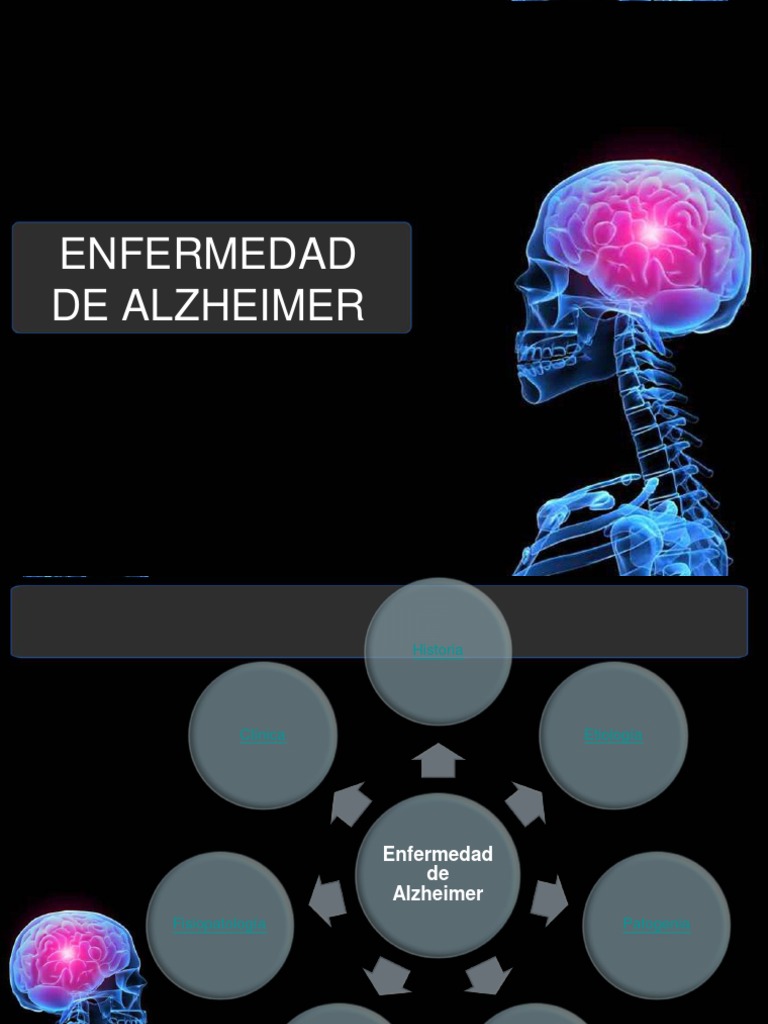 Enfermedad de Alzheimer.ppt | Enfermedad de Alzheimer | Neurología