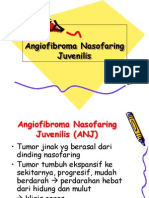 AngioFibroma NasoFaring Juvenile