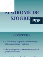 Sindrome de Sjögren