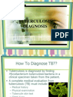 Diagnosis of Tuberculosis