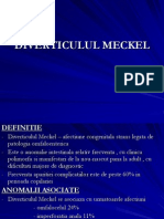 Diverticulul Meckel