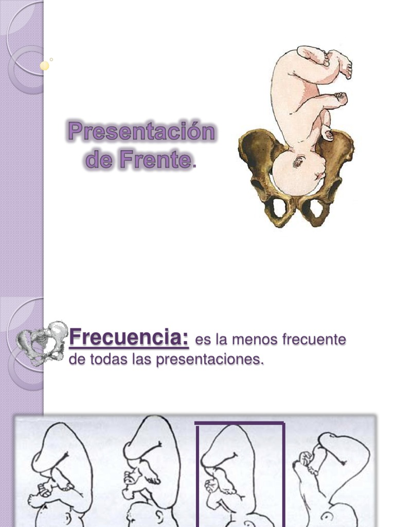 Presentacion de Frente | PDF