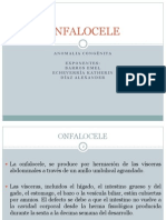 Onfalocele