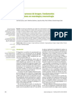 Análisis y proceso de imagen. Fundamentos y aplicaciones en neurología y neurocirugía