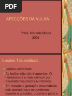 AFECÇÕES DA VULVA