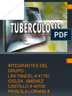 Tuberculosis