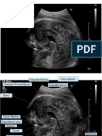 Brain Ultrasound