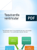 Taquicardia Ventricular